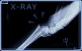 Unusual Limits X-ray